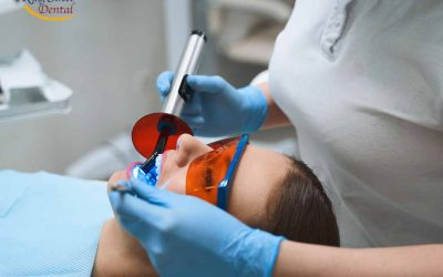 How to Prepare for a Root Canal