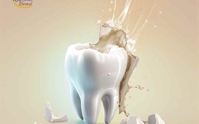 Link Between Oral Health and Nutrition